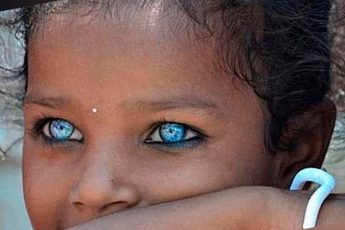 10 людей с самыми необычными и прекрасными глазами в мире