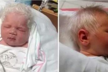 Мальчик родился с белыми волосами. Врачи объявили его альбиносом, но вскоре раскрылась вся правда…