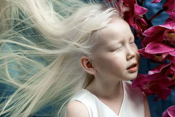 8-летняя девочка-альбинос из Якутии покоряет модельные агентства и интернет